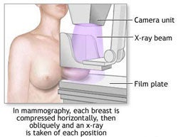 picture of mammography machine