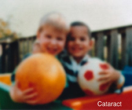 Image viewed with someone who has a cataract