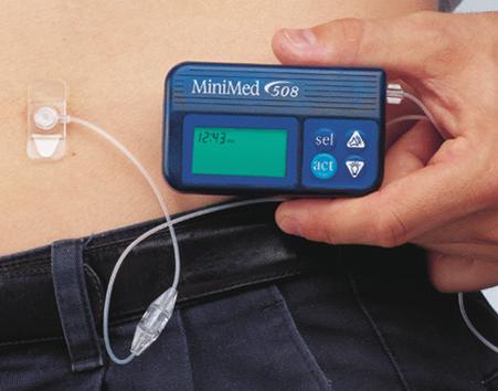 insulin pump