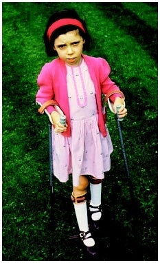 Young girl using walker to support her knees