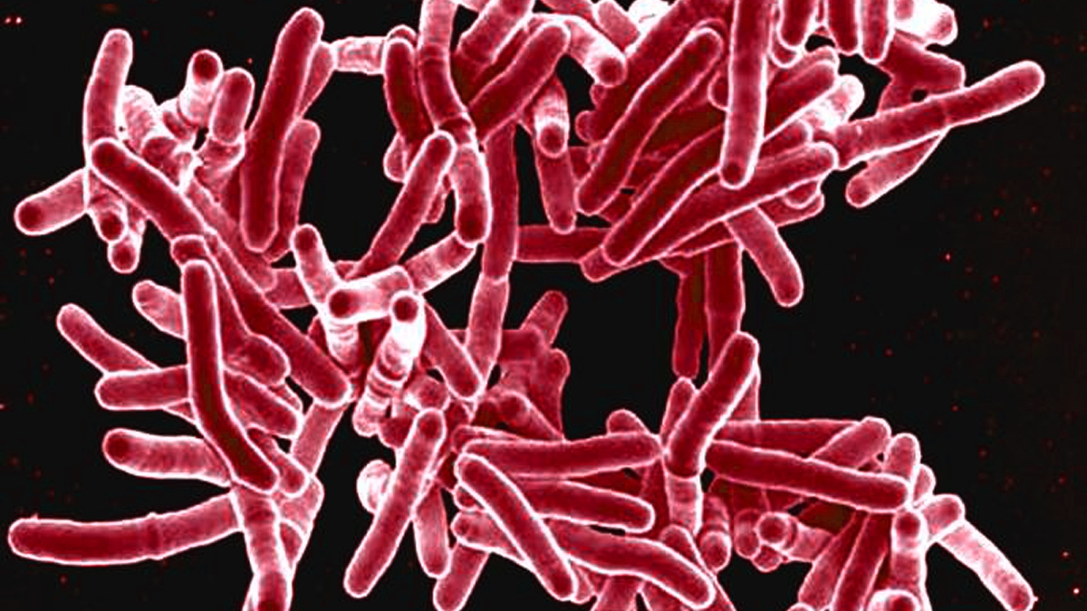 red-colored TB bacteria under a microscope
